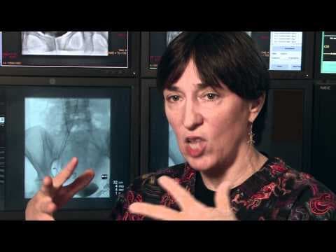 Hipertenzija pogoduje rastu mioma