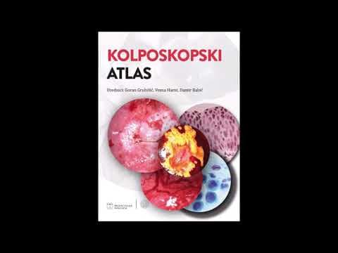 Normalni kolposkopski nalazi