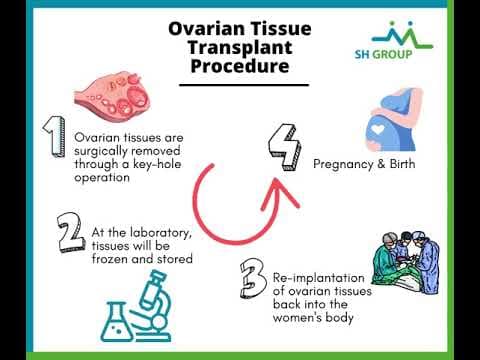 Transplantaciji tkiva jajnika za odgodu menopauze?