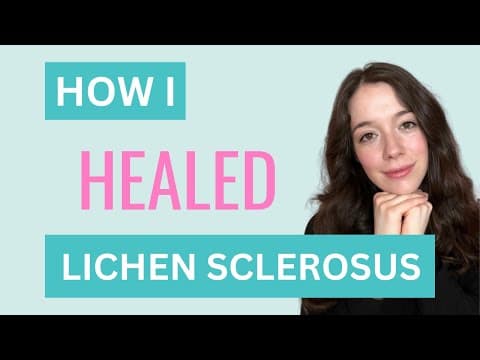 Liječenje lihena sklerozusa vulve frakcijskim CO2 laserom
