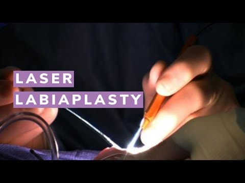 Laserska operacija labioplastike