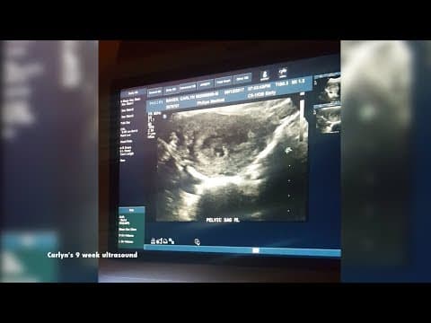 Nova nada za žene s ponavljajućim pobačajima