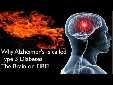 Estrogenska terapija povezana s atrofijom mozga kod žena s dijabetesom