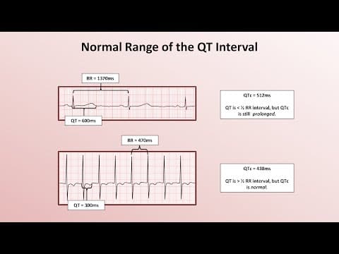 Samogestagenska kontracepcija povezana sa srčanim događajima u sindromu dugog QT intervala