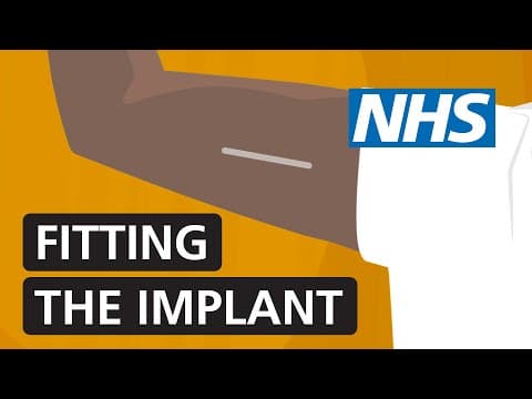 Kontracepcijski implantat