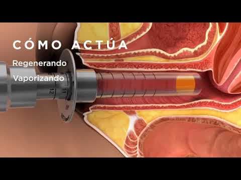 Mehanizam djelovanja lasera na kožu i vaginalno tkivo