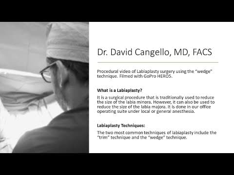 Labioplastika po metodi dr. Harni