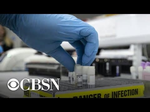 Pfizer cjepivo ne utječe na spermatozoide