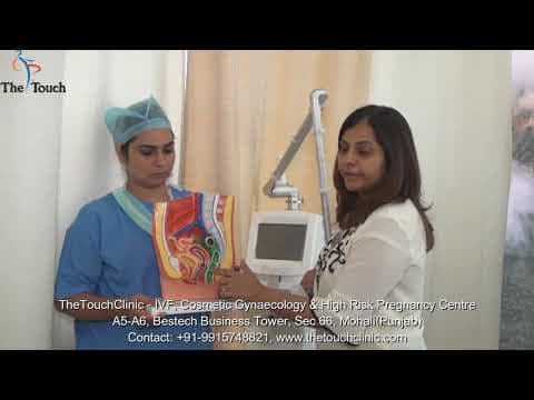 Tretman CO2 laserom za stresnu inkontinenciju u žena