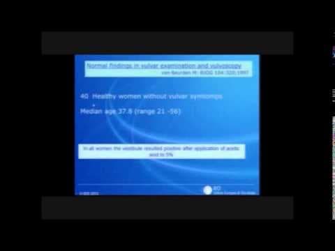 "Vulvoskopija tri prstena" – Novi pristup vulvi