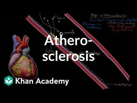 Dijabetes u trudnoći ukazuje na mogućnost ateroskleroze u srednjoj dobi