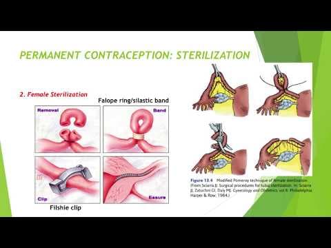 Broj žena koje koriste suvremenu kontracepciju nepromijenjen