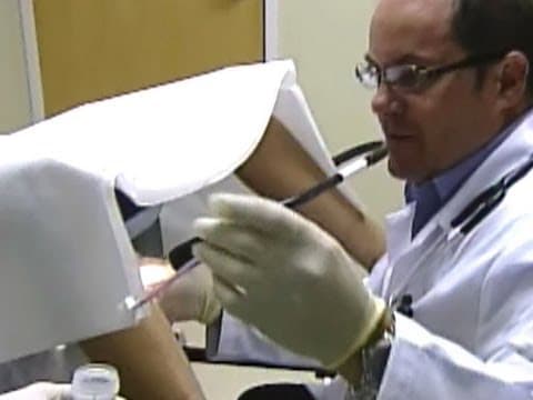 Probir na rak vrata maternice neučinkovit u SAD, potrebna poboljšanja