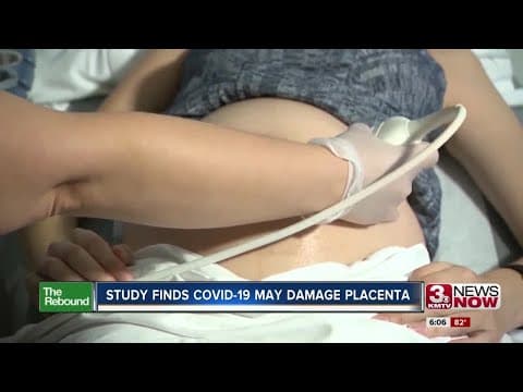 Placentarna koronavirusna infekcija možda je češća u ranoj trudnoći