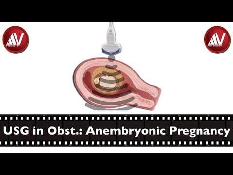 Čimbenici ranog spontanog pobačaja