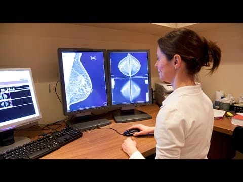 Guste dojke – vodeći čimbenik rizika za karcinom dojke?