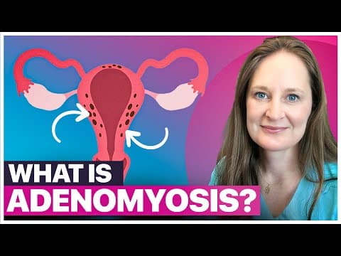 Hormonska spirala učinkovito ublažava simptome adenomioze