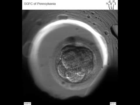 Novosti u IVF tehnologiji: Siguran i učinkovit način koji može smanjiti troškove