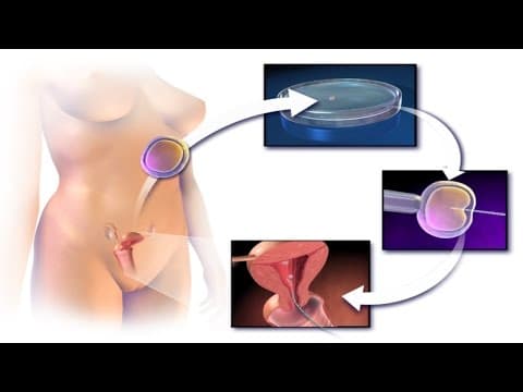 Muškarci rođeni iz ICSI postupka teže ostvaruju potomstvo