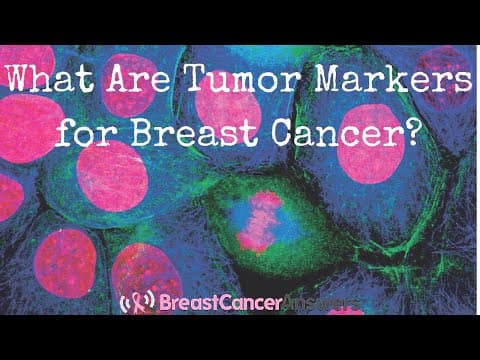 Otkriven novi biljeg za rak dojke